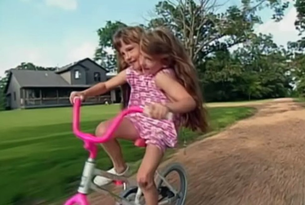 Abby e Brittany Hensel, na infância em Minnesota — Foto: Reprodução