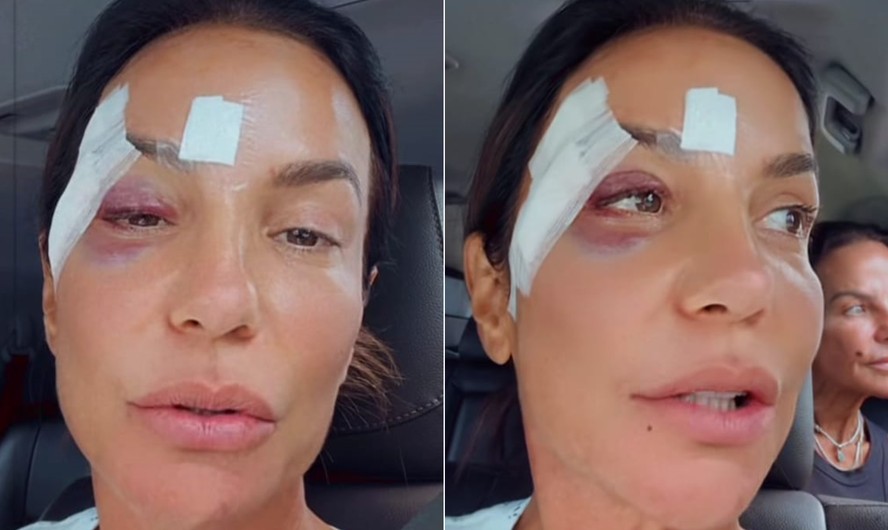 Ivete Sangalo recebe alta hospitalar