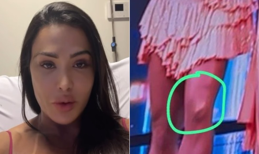 Gracyanne Barbosa se emociona ao falar sobre saída do 'Dança dos famosos' e lesão — Foto: Reprodução/Instagram