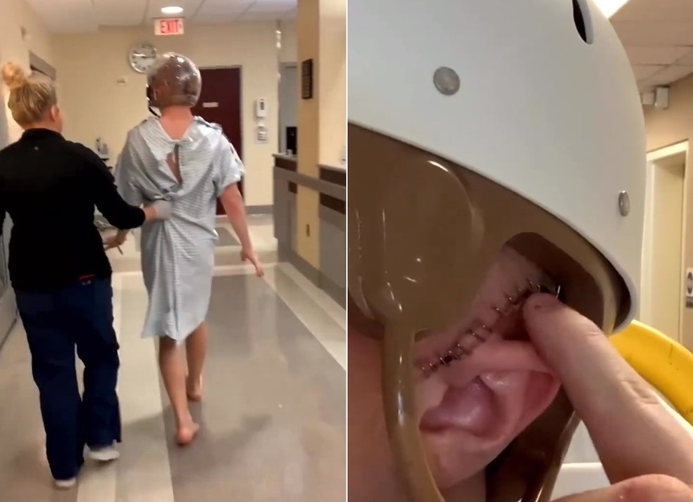 Brandon precisou ter o crânio removido para lavagem do cérebro após contrair infecção — Foto: Reprodução/Instagram