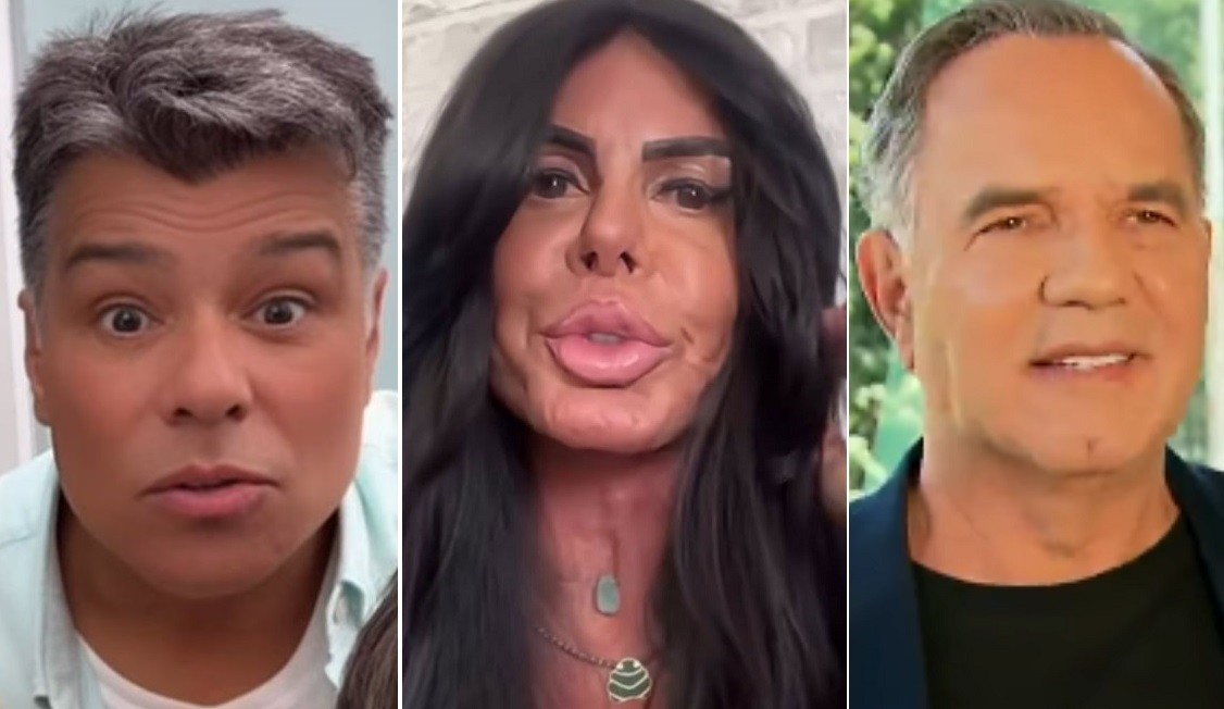 Harmonização facial dos famosos: especialista alerta sobre exageros e defende naturalidade
