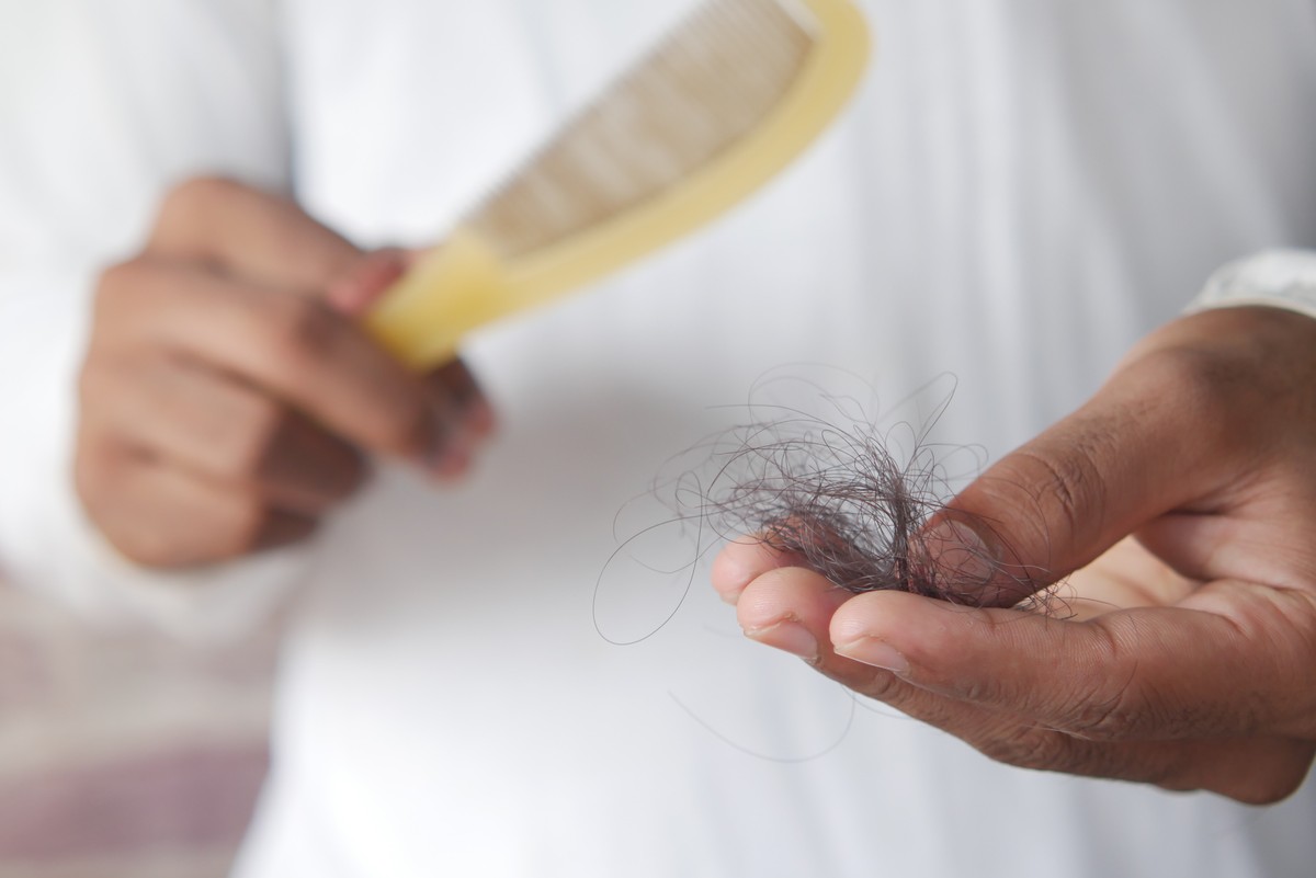 Perda de Cabelo: Por que Profissionais Estão Enfrentando Calvície em Massa?