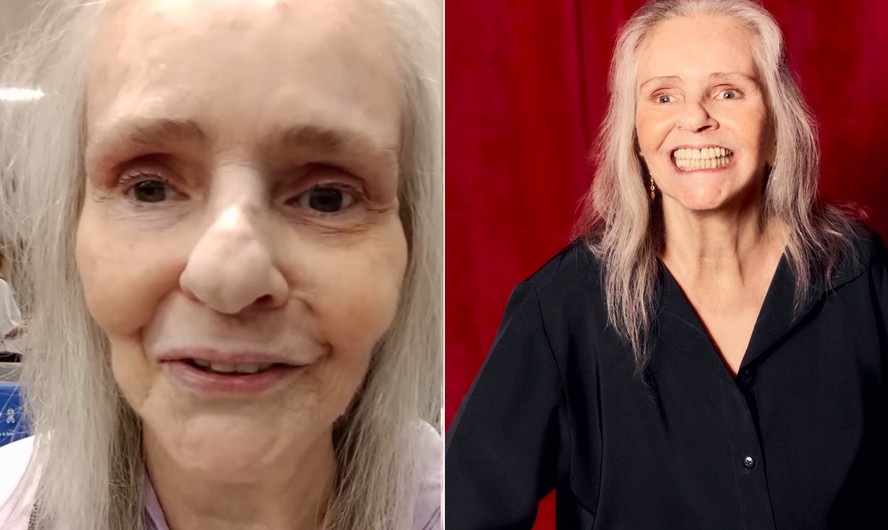 Angela Ro Ro fez vídeo sobre estado de saúde