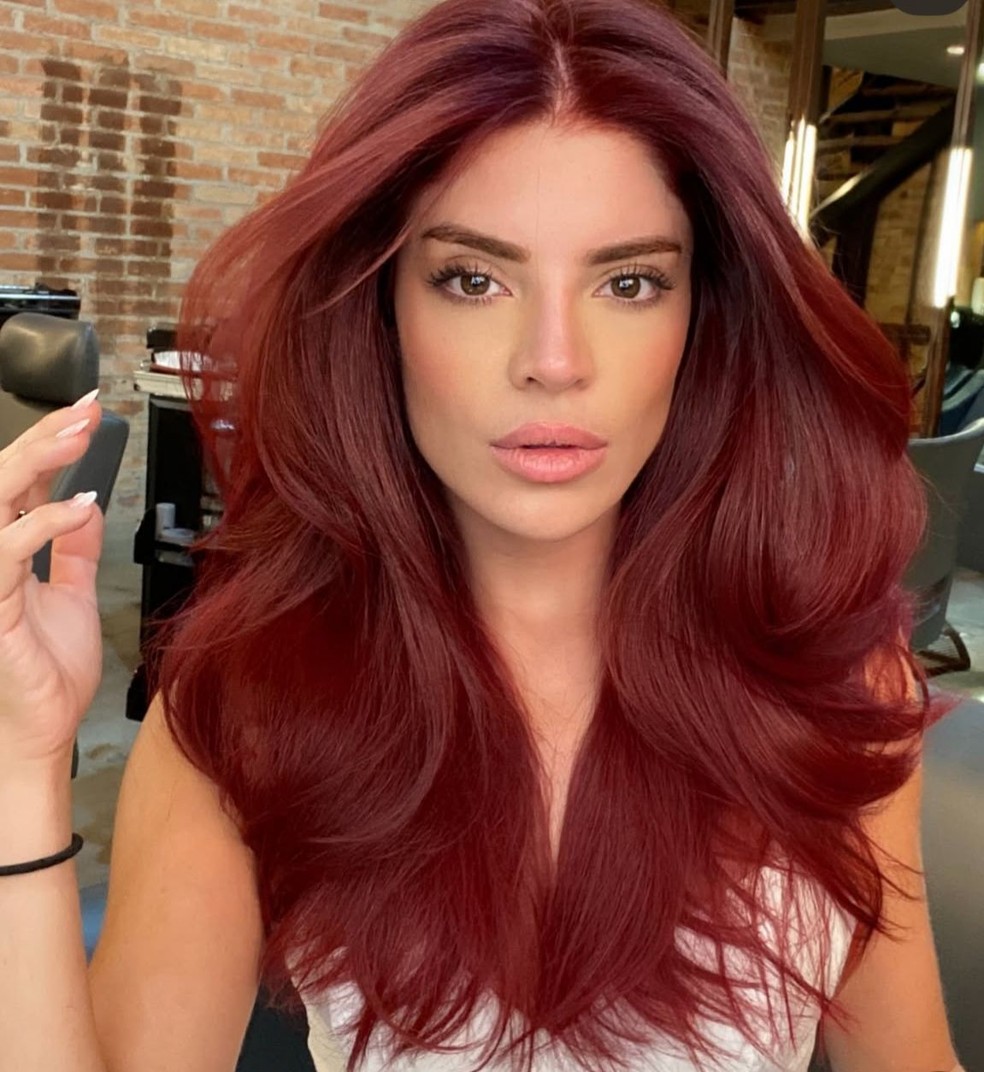 Gkay após retirar o preenchimento labial — Foto: Instagram