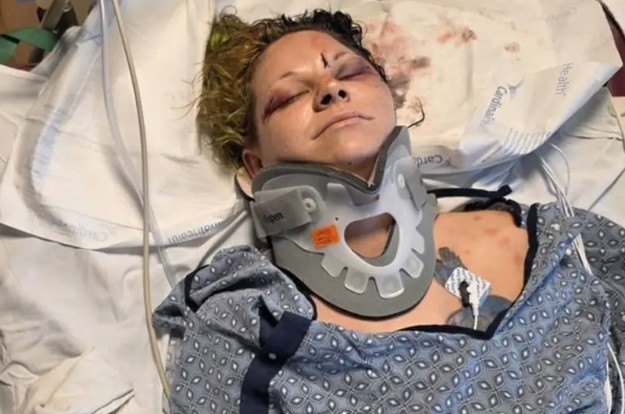 Mulher é golpeada com tesoura pelo noivo um mês antes do casamento