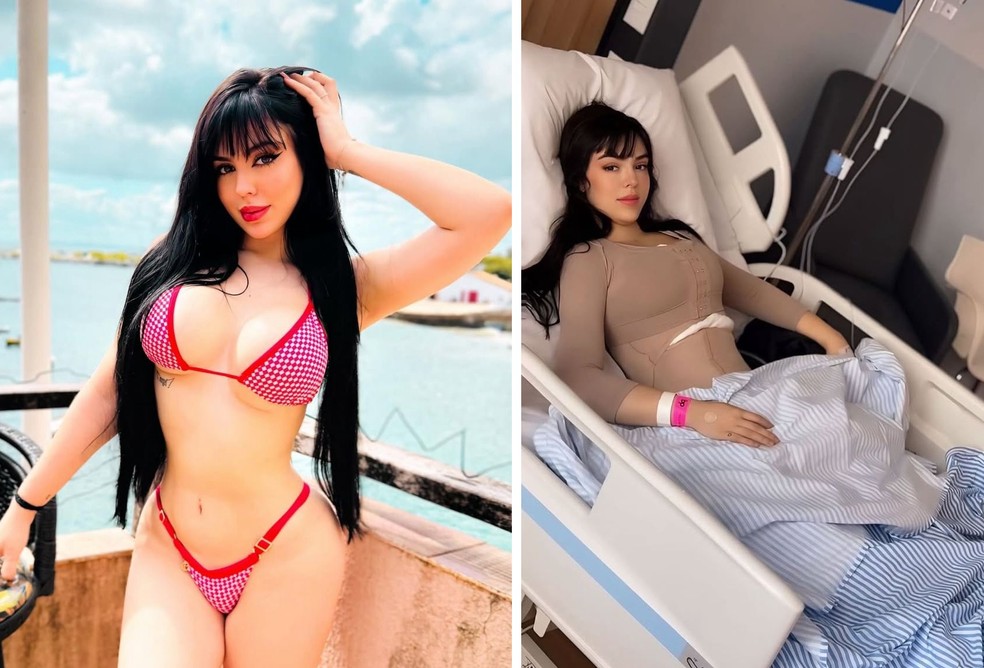 Aos 20 anos, irmã de MC Melody faz nova lipo e aumenta os seios — Foto: Instagram