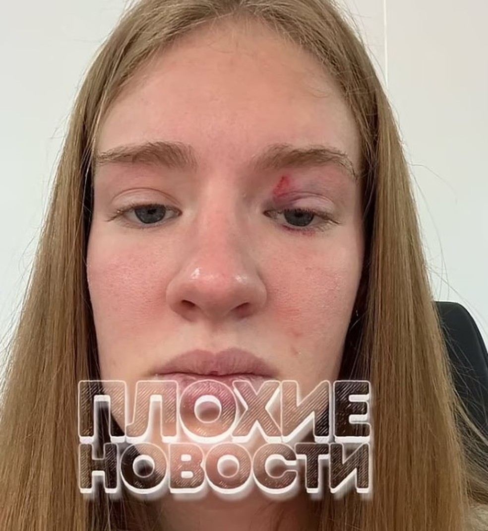 Masha, 'sereia' em aquário chinês, exibe ferimento após ser atacada por peixe — Foto: Reprodução