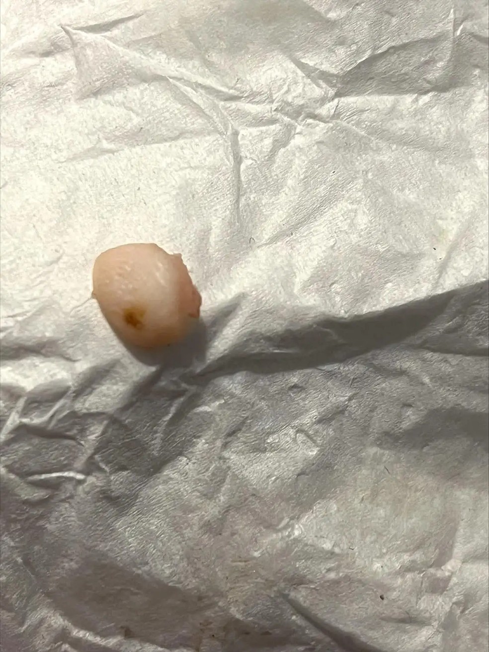 Ponta do dedo supostamente encontrada por Mary Elizabeth Smith &mdash; Foto: Reprodu&ccedil;&atilde;o / Greenberg Law PC