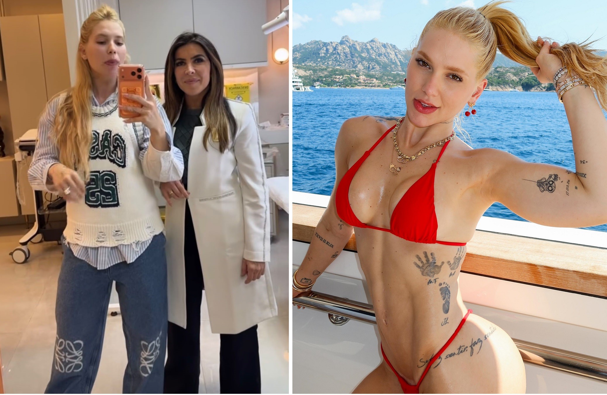 Virginia Fonseca faz sessão de laser íntimo; saiba o que é