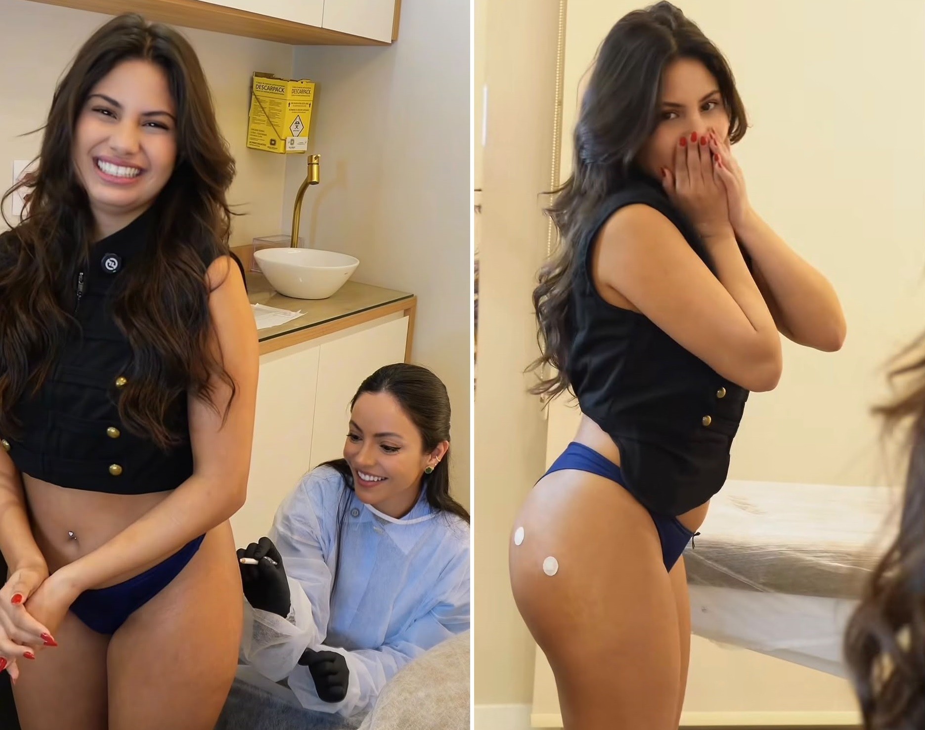 Ex-BBB Gabriela Panquequinha faz harmonização no bumbum e celebra resultado - QTU Questões do Universo