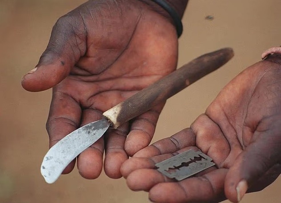 Materiais usados em circuncis&otilde;es criminosas de adolescentes na &Aacute;frica do Sul &mdash; Foto: Reprodu&ccedil;&atilde;o
