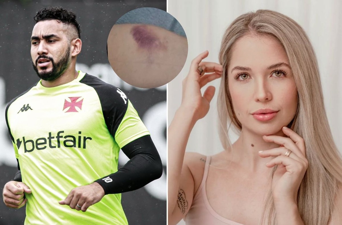 Dimitri Payet, do Vasco, nega ter agredido advogada e diz que beber urina era comum entre o casal
