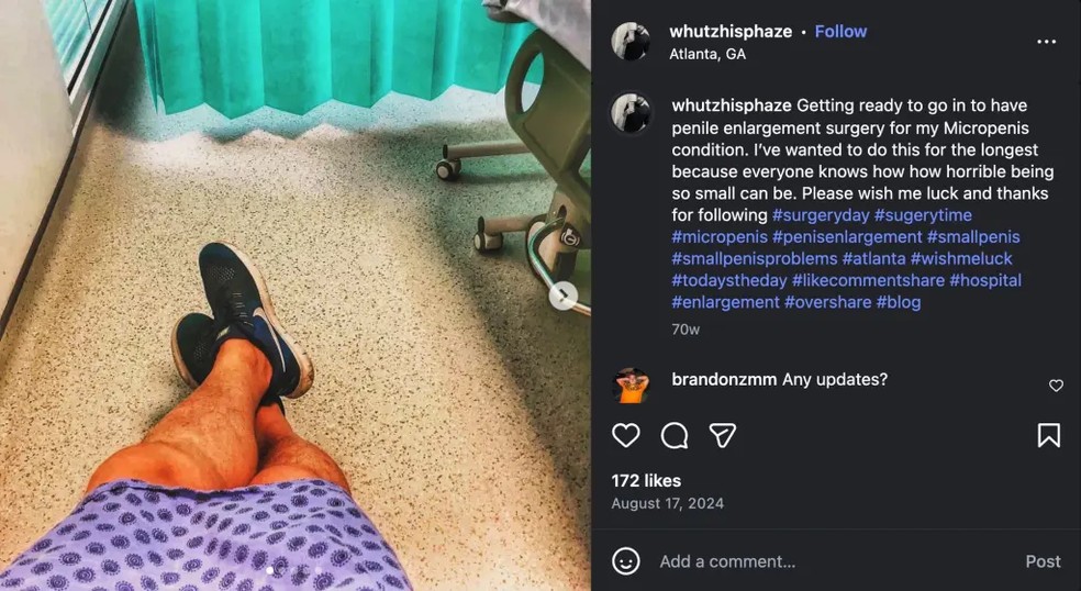 Phillips chegou a marcar operação em 2024, mas desistiu de última hora — Foto: Instagram/Reprodução