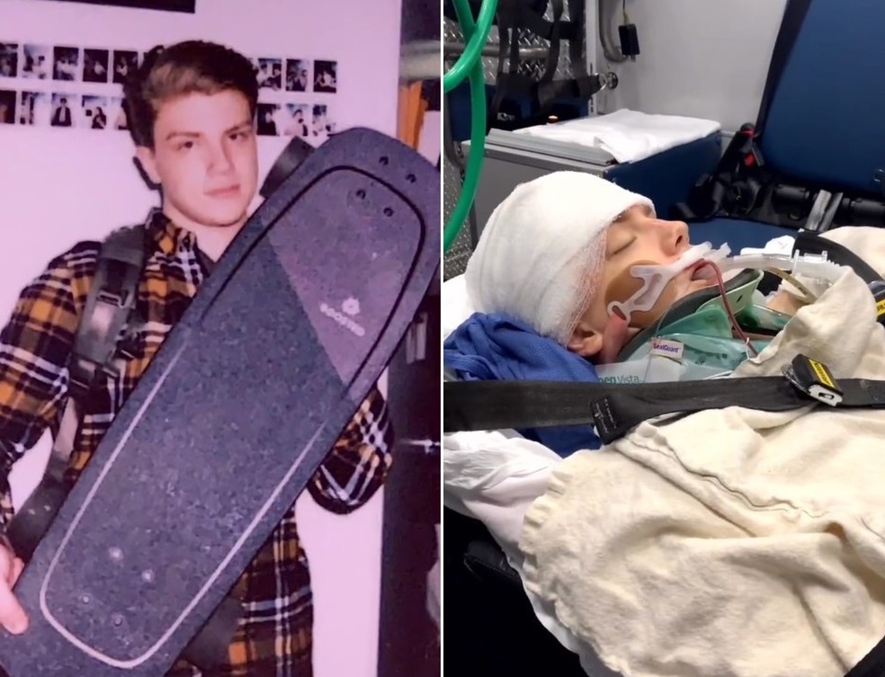 Brandon teve lesão cerebral após cair de skate nos EUA — Foto: Reprodução/Instagram