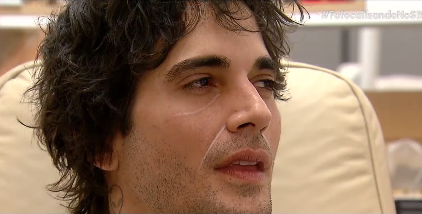 Rinomodelação e ácido hialurônico: saiba como foi a harmonização facial de Fiuk