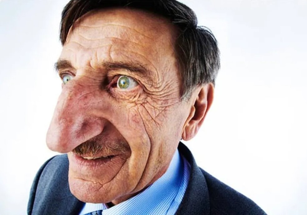 Mehmet Özyürek, com nariz de 'apenas' 8,8 centímetros — Foto: Divulgação/Guinness World Records