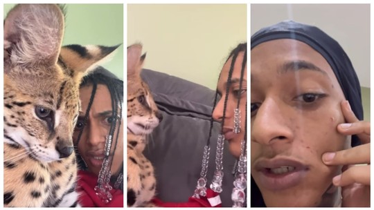 Rapper Oruam mostra arranhões no rosto por ataque de seu pet: 'Gato mais famoso do Brasil'