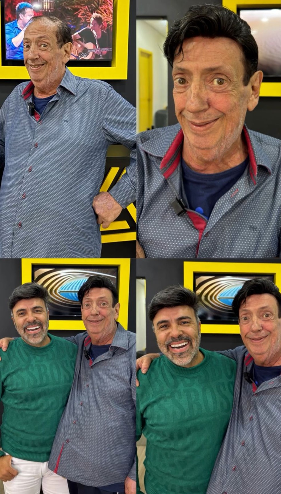 Marcos Oliveira, o Beiçola de 'A grande família', coloca prótese capilar e exibe o novo visual — Foto: Instagram