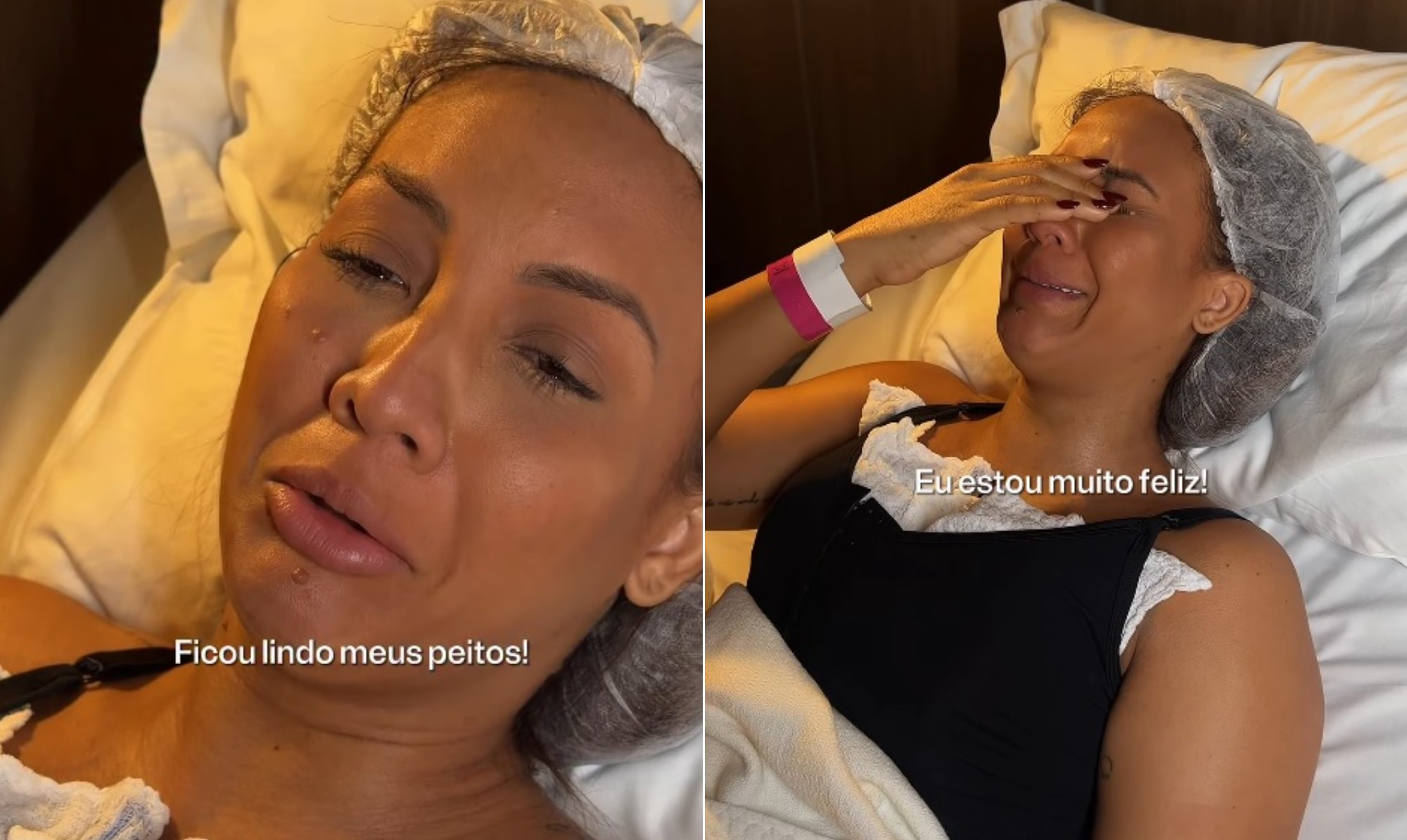 Ex-BBB Maxiane realiza sonho de fazer mastopexia com prótese: 'Muito feliz de viver esse momento'