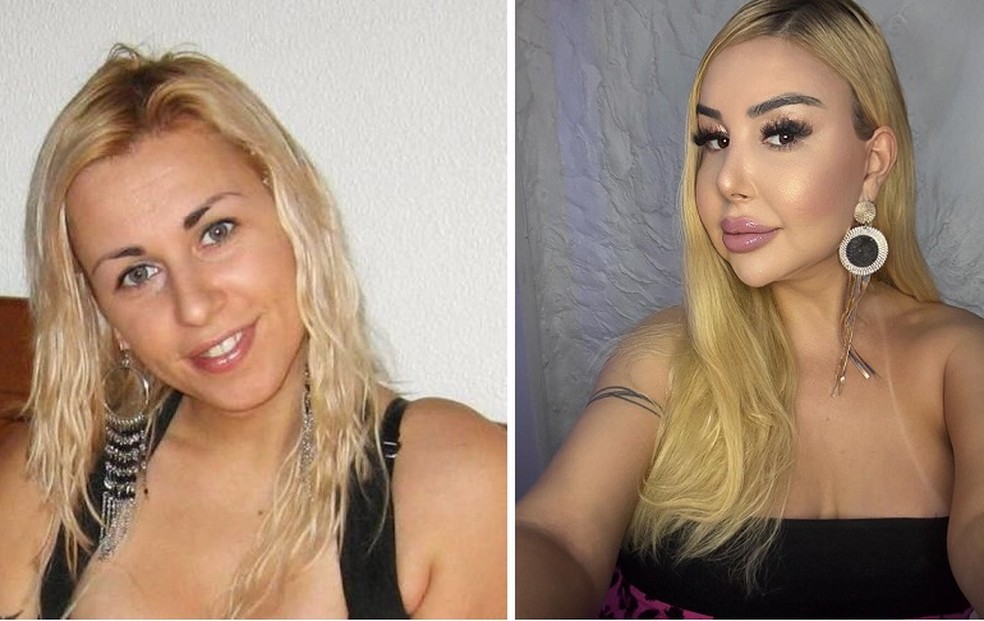 Cantora trans portuguesa Patrícia Ribeiro se arrepende de silicone industrial — Foto: Arquivo pessoal