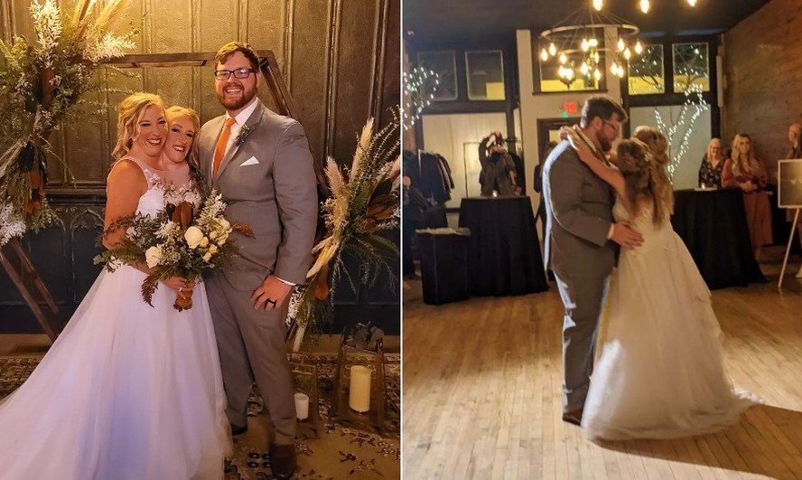 Gêmeas siamesas Abby e Brittany Hensel divulgam imagens inéditas do