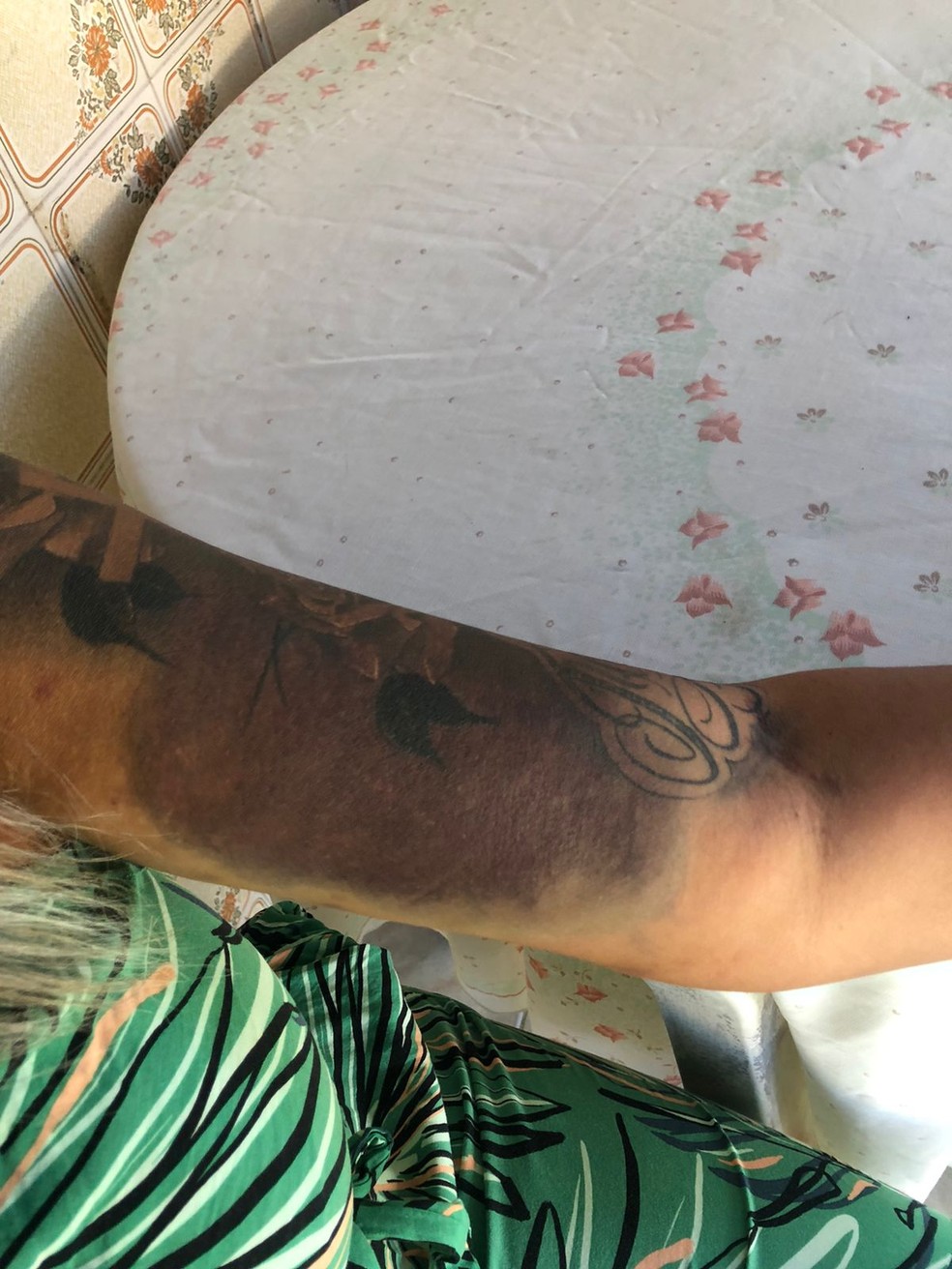 A marca da agressão num dos braços de Adriana — Foto: Arquivo pessoal