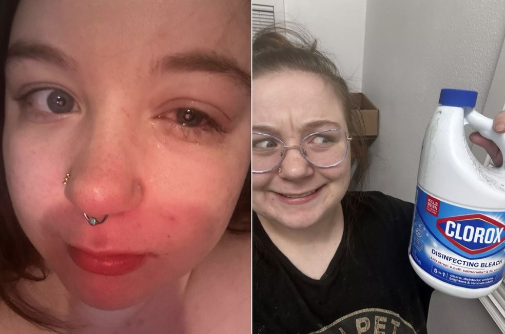 Dejah teve lesão na córnea do olho direito — Foto: Reprodução