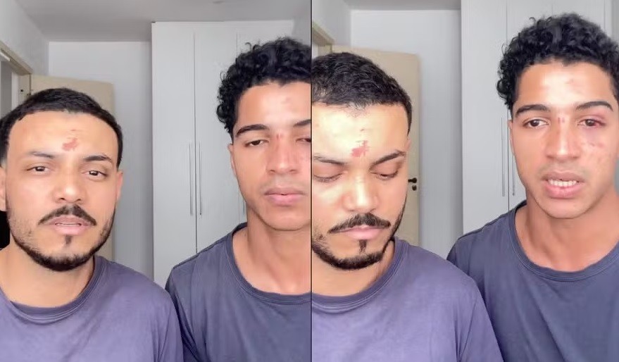 Aluno relata agressão e homofobia que sofreu com o namorado após festa em prédio da UFRJ
