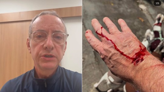 Âncora do 'SP2', José Roberto Burnier é atacado por pitbull solto durante passeio Âncora do 'SP2', José Roberto Burnier é atacado por pitbull solto durante passeio