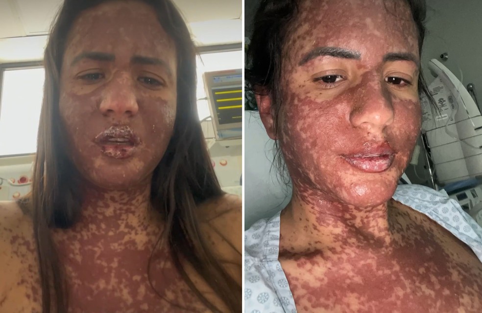 Mulher de Frank Aguiar relata internação na UTI com com doença rara — Foto: Instagram