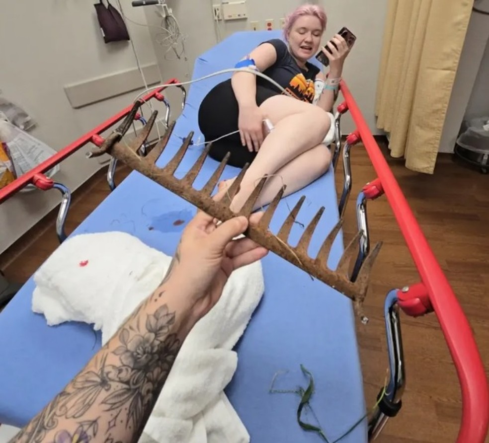 Mary Doyon acabou com p&eacute; cravado em ancinho enferrujado ao caminhar descal&ccedil;a pelo jardim de casa com o filho &mdash; Foto: Reprodu&ccedil;&atilde;o/TikTok