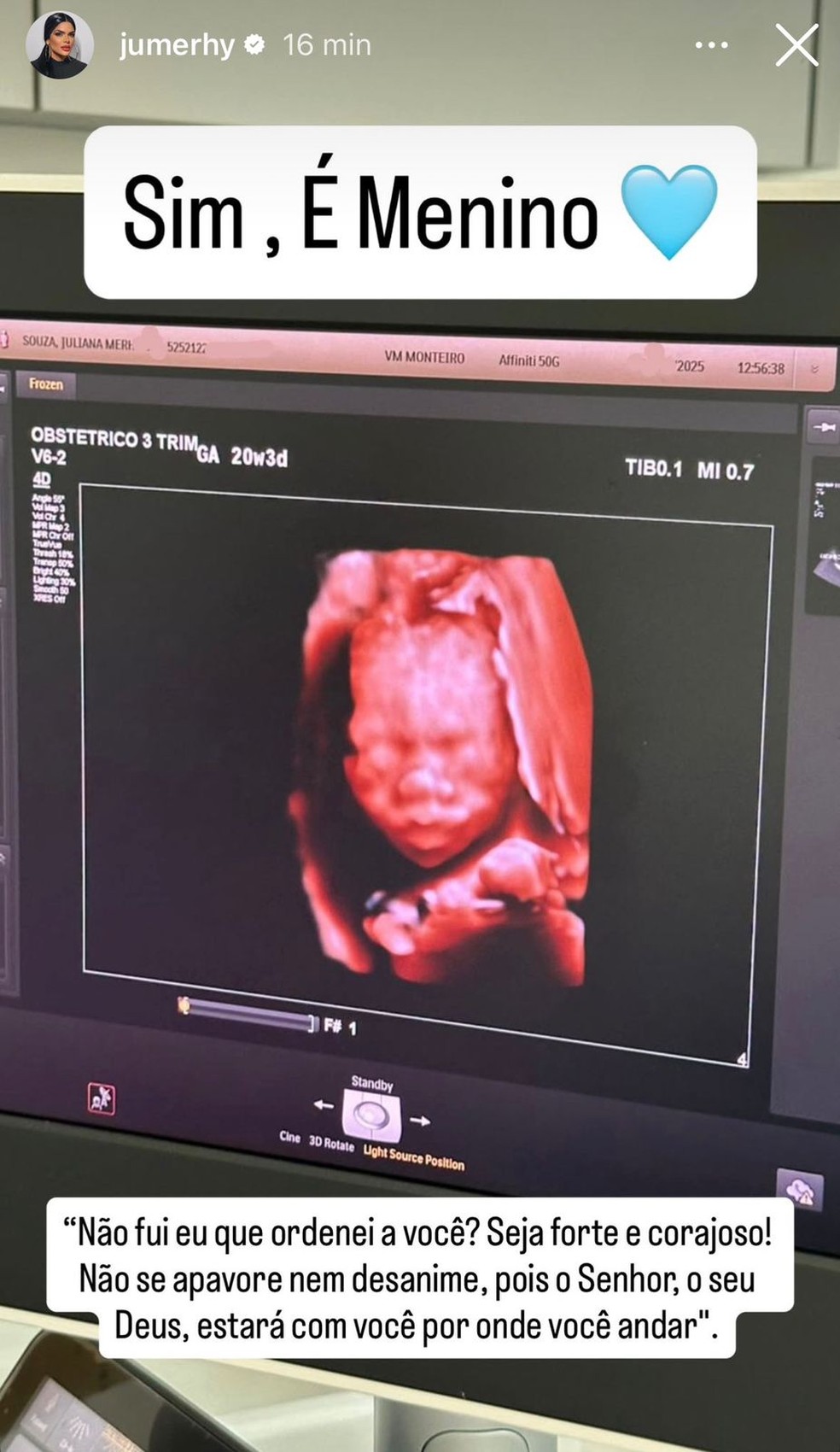 Juliana Merhy (à esquerda) está grávida do zagueiro Gil Baloi, que namora a BBB Elana — Foto: Reprodução/Instagram