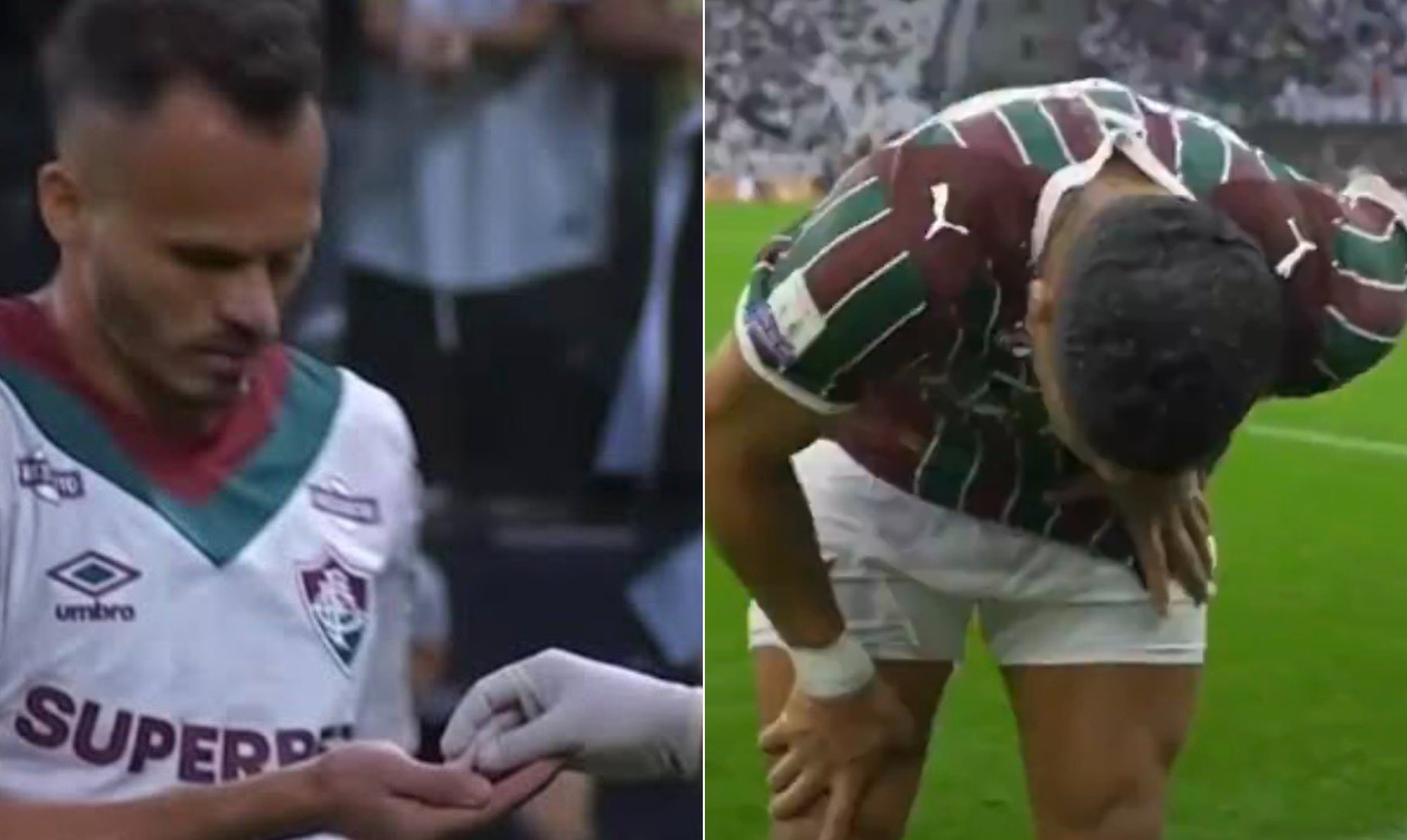 Tem receita? Hulk passa mal, toma remédio e repete roteiro decisivo de Renê em nova vitória do Fluminense sobre o Corinthians