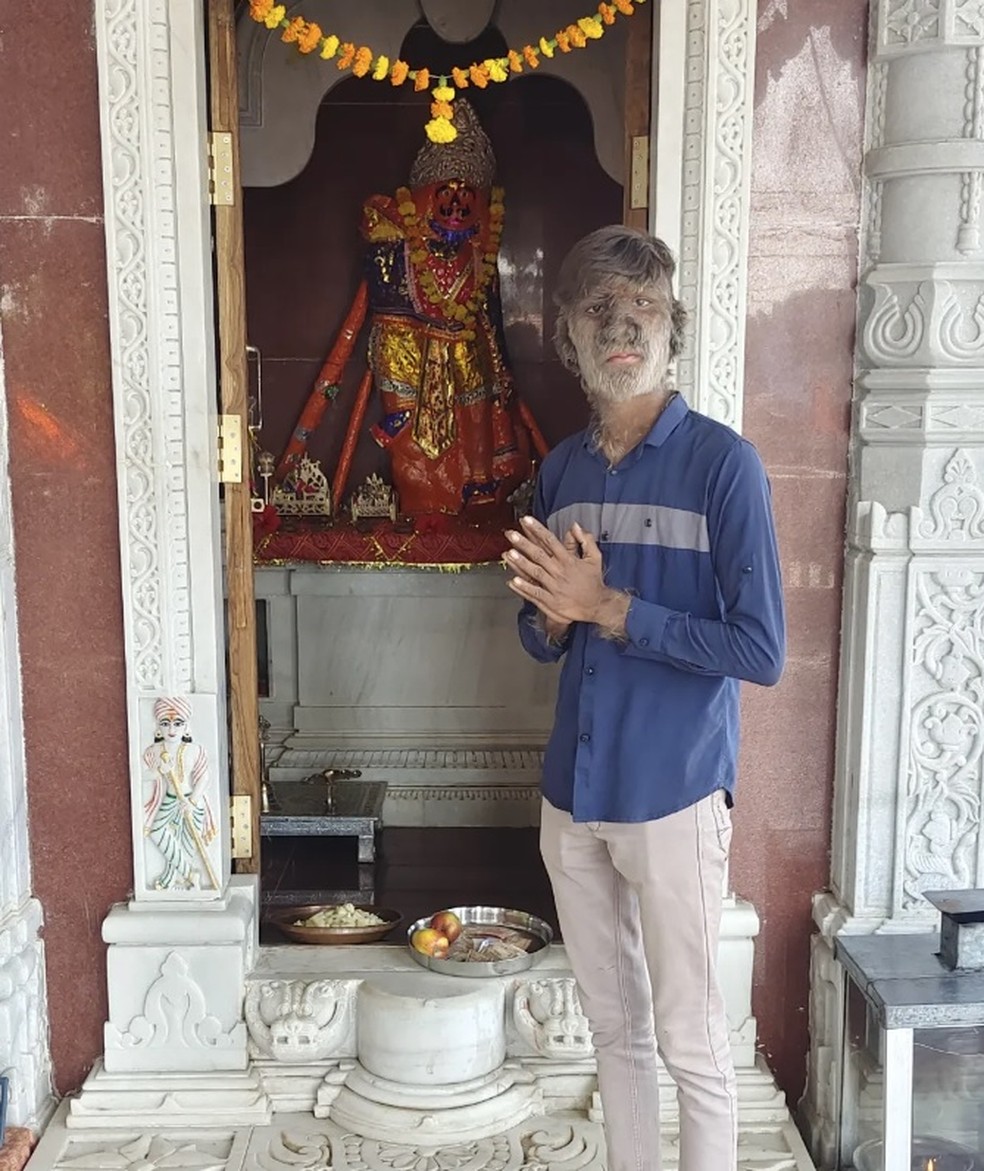 Indiano Lalit Patidar, de 19 anos, tem o rosto mais peludo do mundo — Foto: Reprodução/Instagram