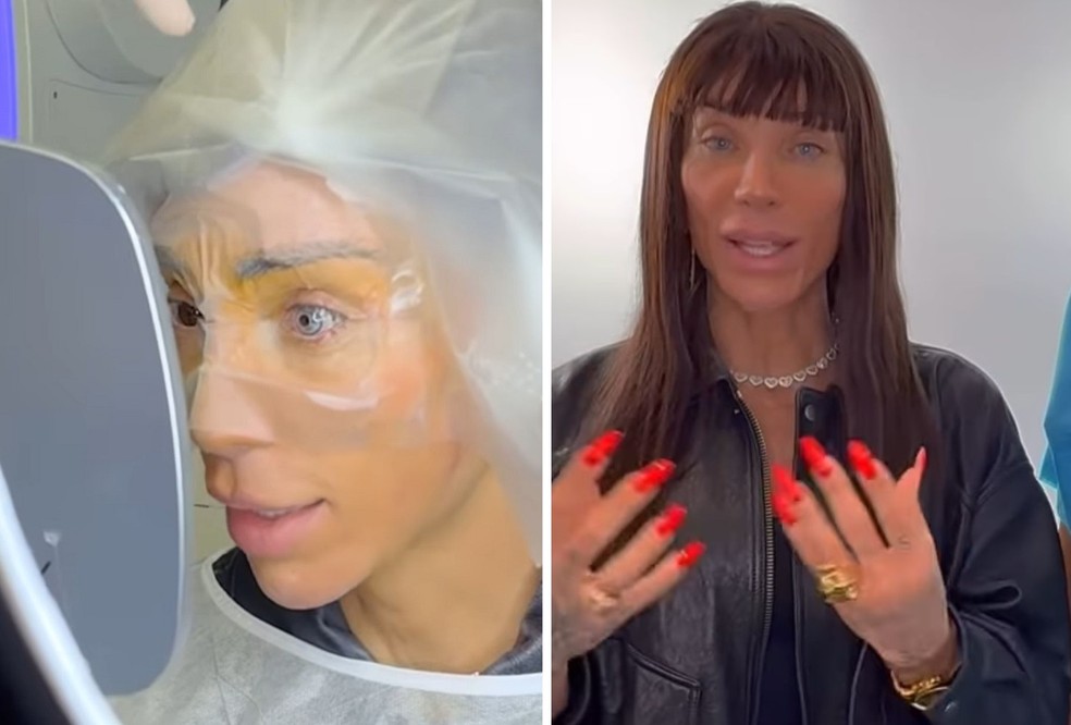 Maya Massafera mostra cirurgia para mudar cor dos olhos e choca web — Foto: Instagram