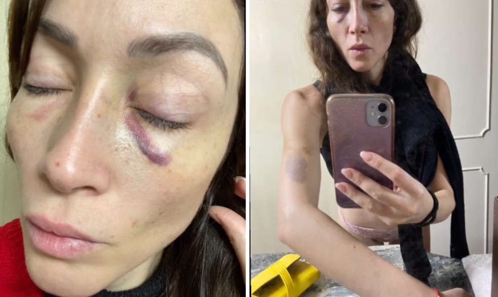 Laura Vignatti também denunciou Salvador Zubirán Rabay por agressão — Foto: Reprodução / Instagram