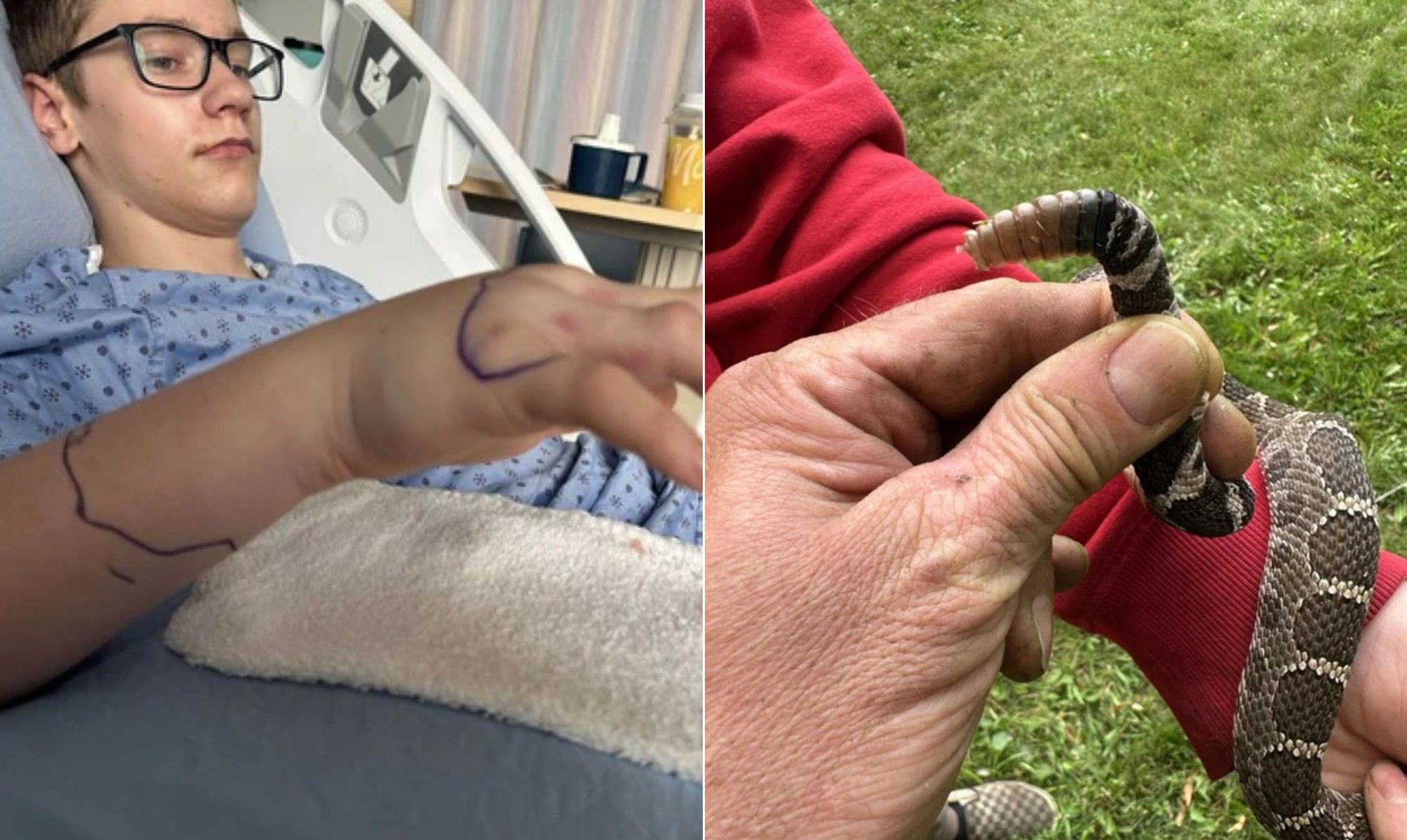 Pai confunde cascavel com cobra inofensiva, e filho é picado durante jardinagem no Canadá - QTU Questões do Universo