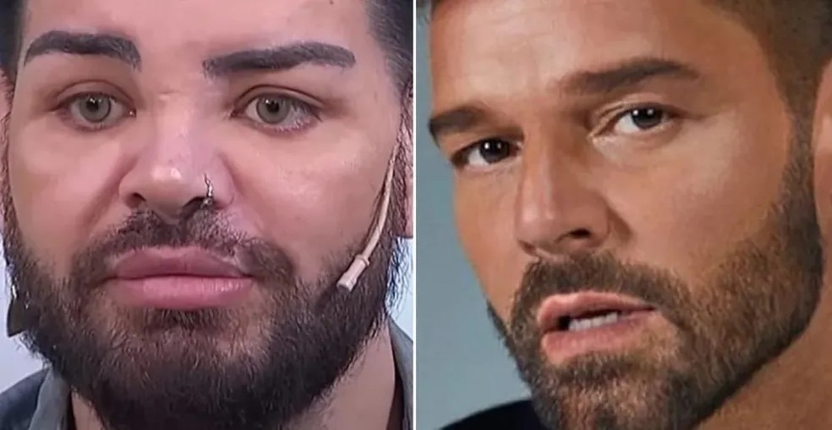 Ricky Martin, Angelina Jolie and Michael Jackson: Discover fans who underwent plastic surgery to try to look like their idols |  Entertainment