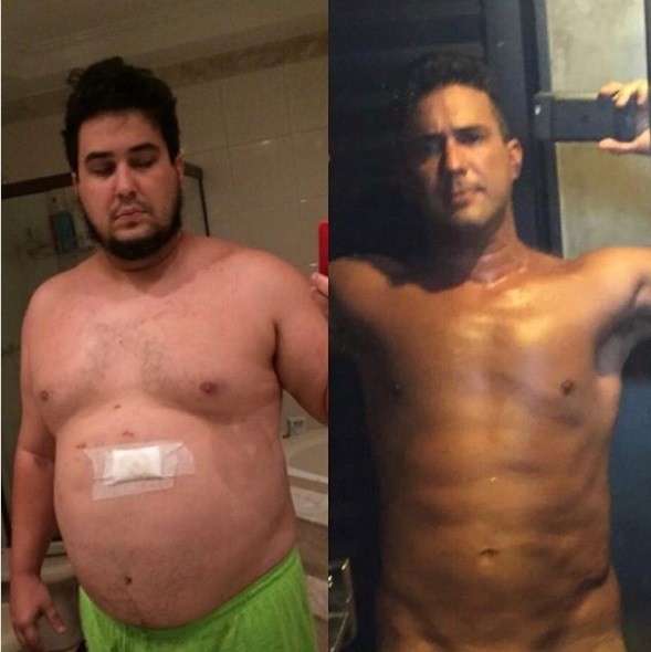 O antes e depois de André Marques — Foto: reprodução/ instagram 