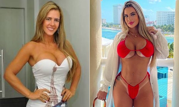 Como Denise Rocha, confira outras famosas que também fizeram cirurgia íntima