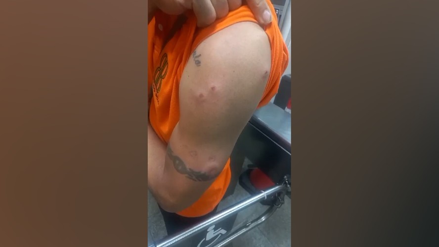As lesões no braço de uma das vítimas do bando