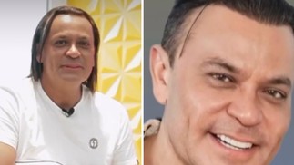 Frank Aguiar celebra harmonização facial — Foto: Instagram