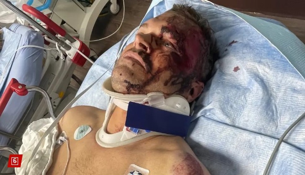 Aric Hutchinson ferido após ser atingido por motorista bêbada ao sair da festa de casamento — Foto: Reprodução