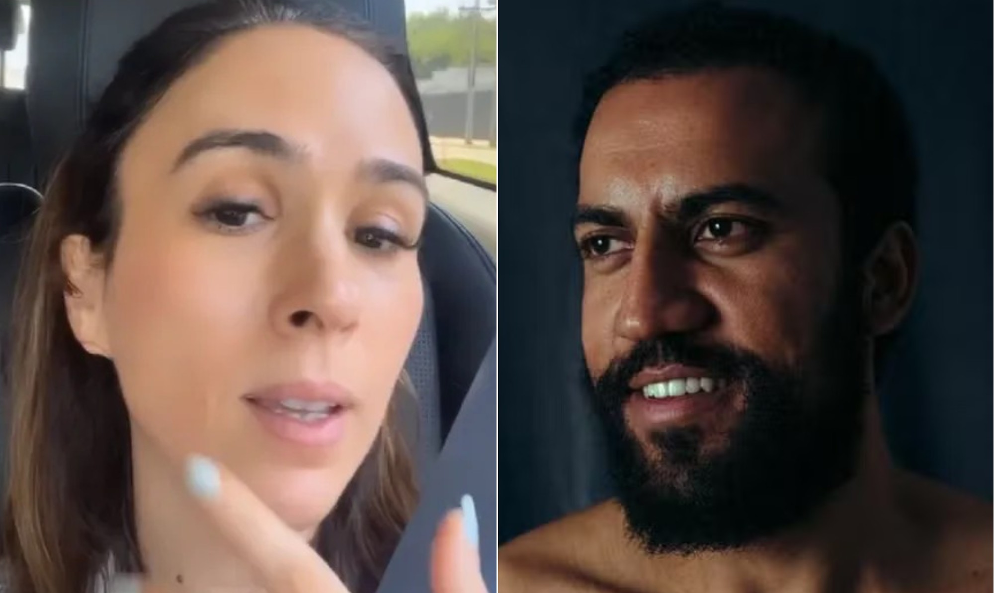 De esperma de salmão a cirurgia na Turquia: confira os procedimentos estéticos e cuidados de beleza do elenco de 'Quem ama cuida'