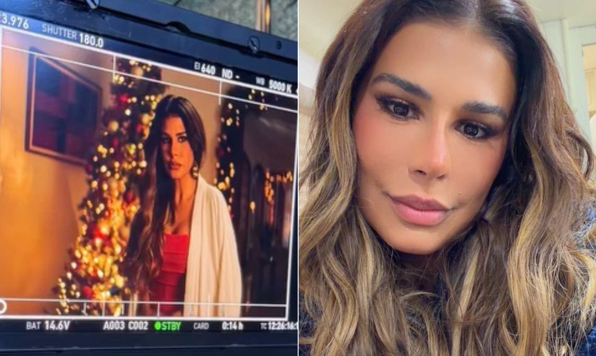 Simone Mendes revela nova intervenção no nariz e grava projeto já inchada