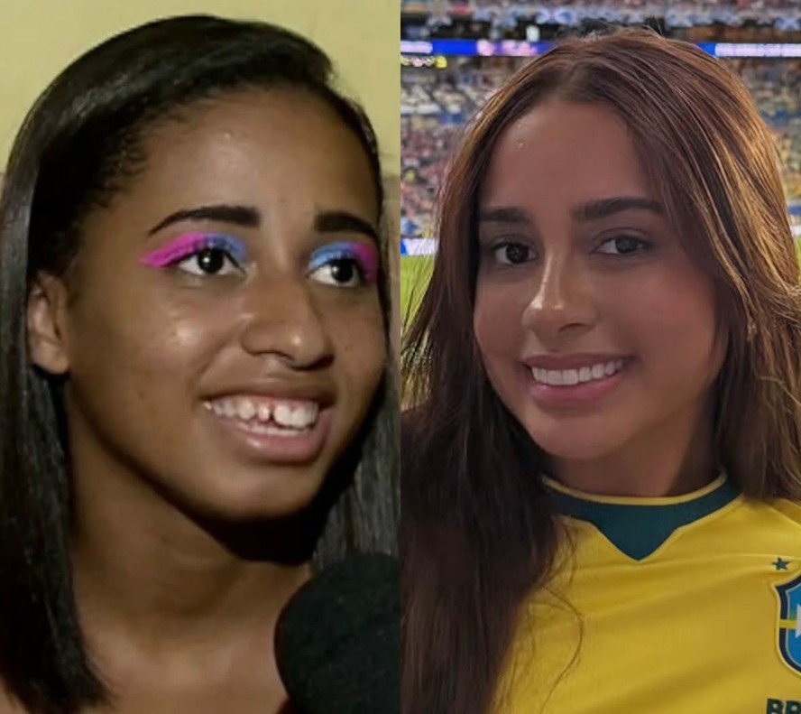 Mudou muito? MC Lomma choca a web com antes e depois: 'Harmonização que ...