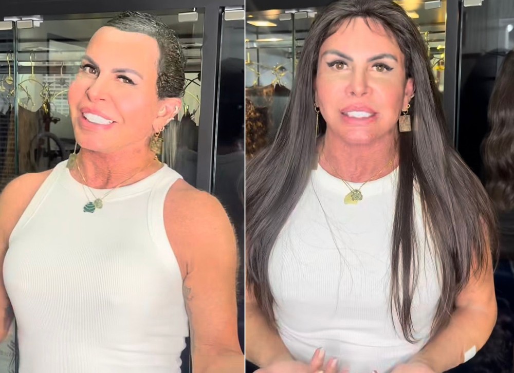 De silicone à cirurgia íntima, Gretchen coleciona procedimentos ...