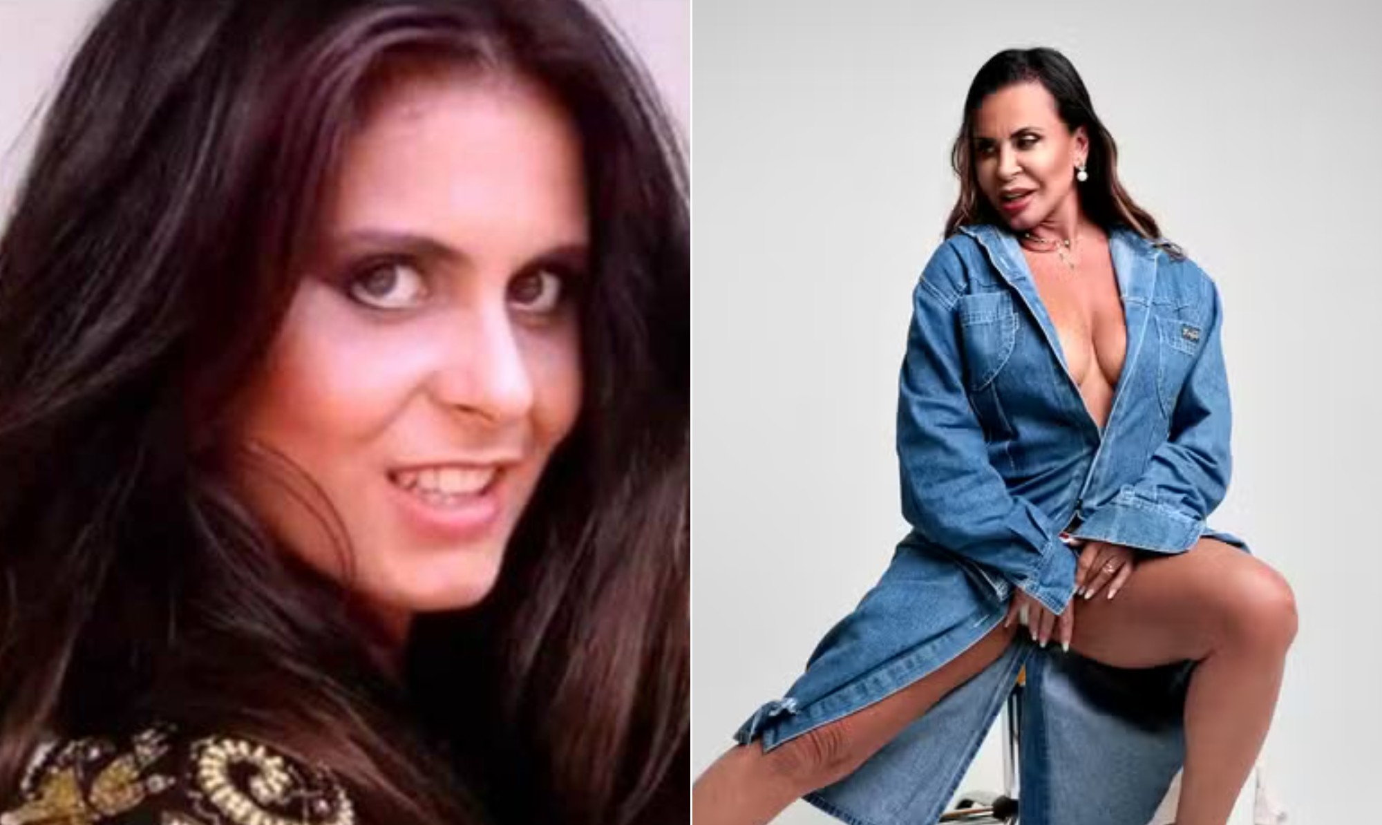 De silicone à cirurgia íntima, Gretchen coleciona procedimentos estéticos e fala abertamente sobre eles