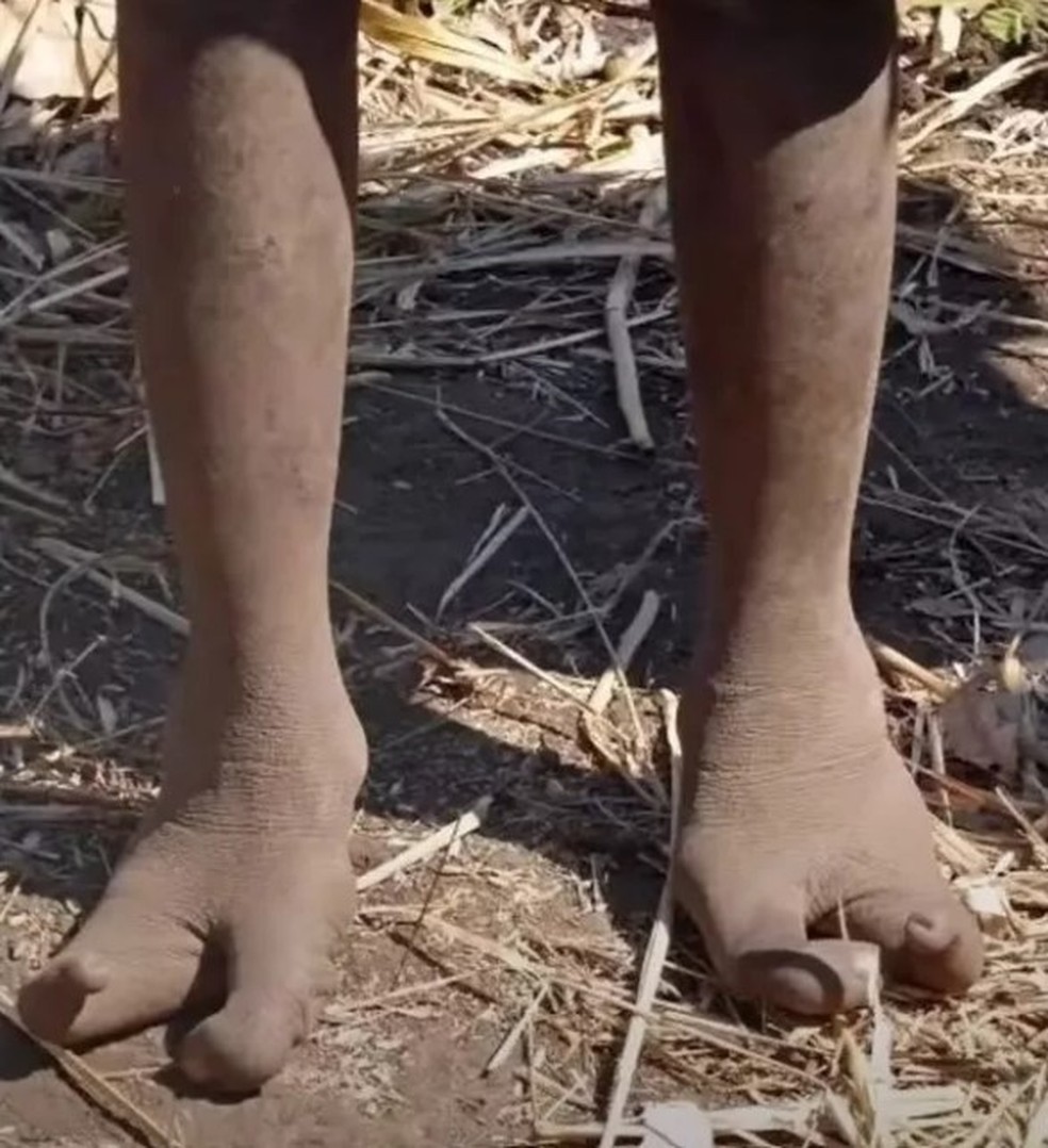'Povo Avestruz': tribo africana chama atenção por mutação genética que deforma os pés — Foto: Reprodução/YouTube