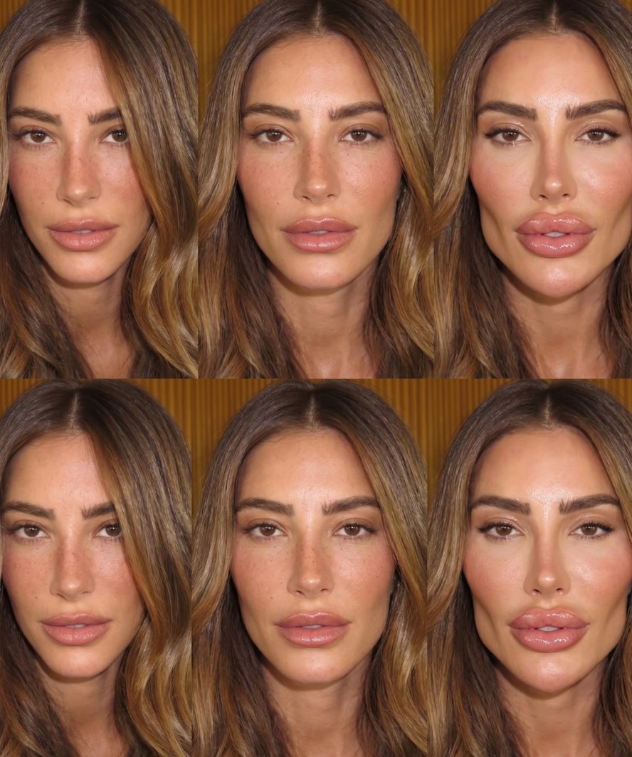 Mulher de Alok, Romana Novais impressiona seguidores com exagero de procedimento em fotos e reflete sobre harmonização facial